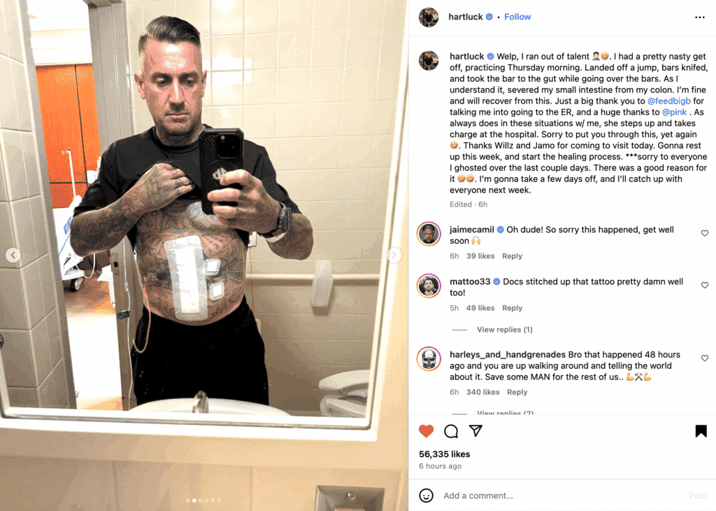 Pink’s husband apologizes to her while showing off horrific injuries | "Welp, I ran out of talent." Celebrity Pink’s husband apologizes to her while showing off horrific injuries