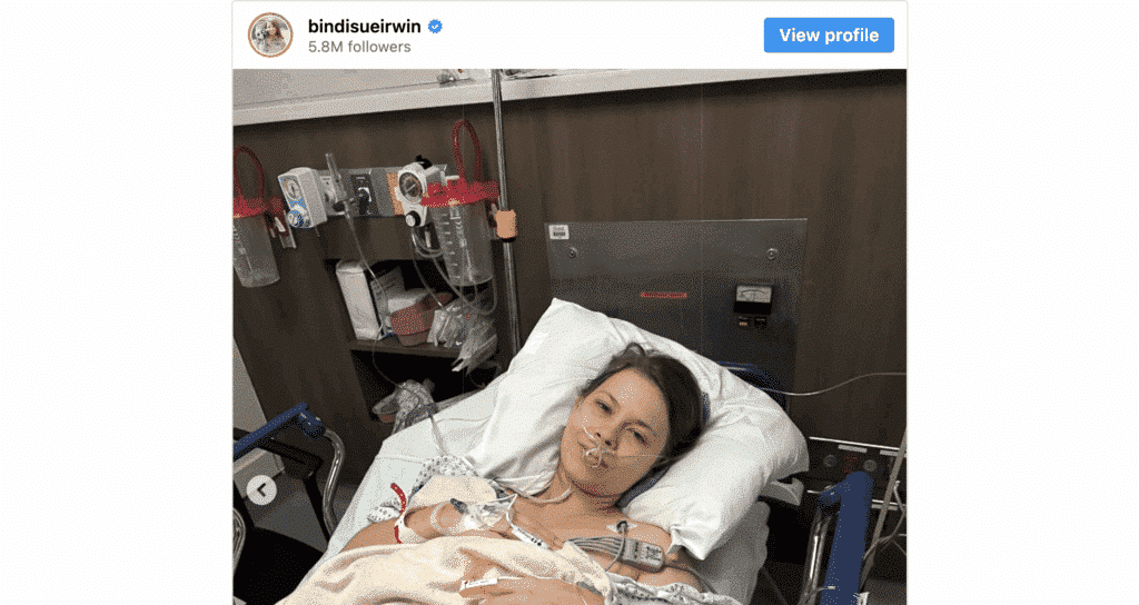 Robert Irwin Praises Sister Bindi Irwin After She Shares Update ...