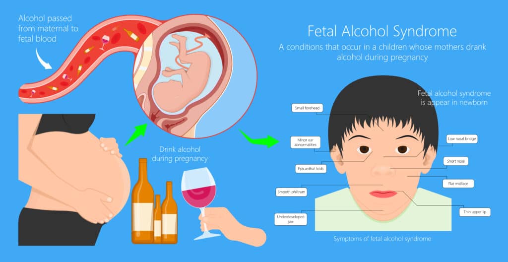 Kentucky mom nearly ‘fainted’ after learning of son’s unusual $4,200 Amazon purchase | “He told me that he wanted to have a carnival.” Lifestyle & Entertainment fetal alcohol spectrum disorder fasd