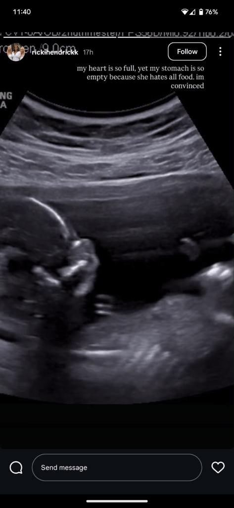 ‘Bachelorette’ alum Emily Maynard Johnson’s 20-year-old daughter announces pregnancy | “My heart is so full, yet my stomach is so empty because she hates all food.” Pregnancy News ricki hendrick pregnancy reveal ultrasound photo